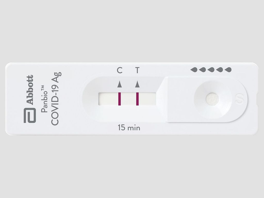 Chất lượng xét nghiệm